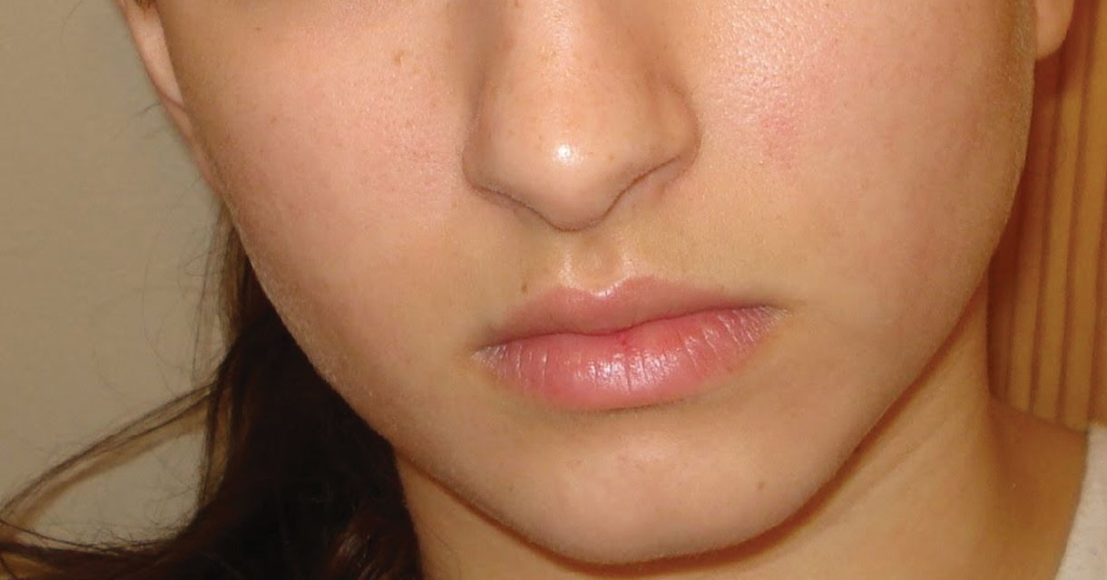 home_beauty2_beforeafter1_1