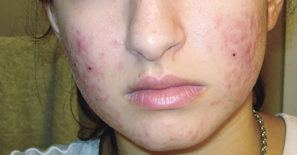 home_beauty2_beforeafter1_2